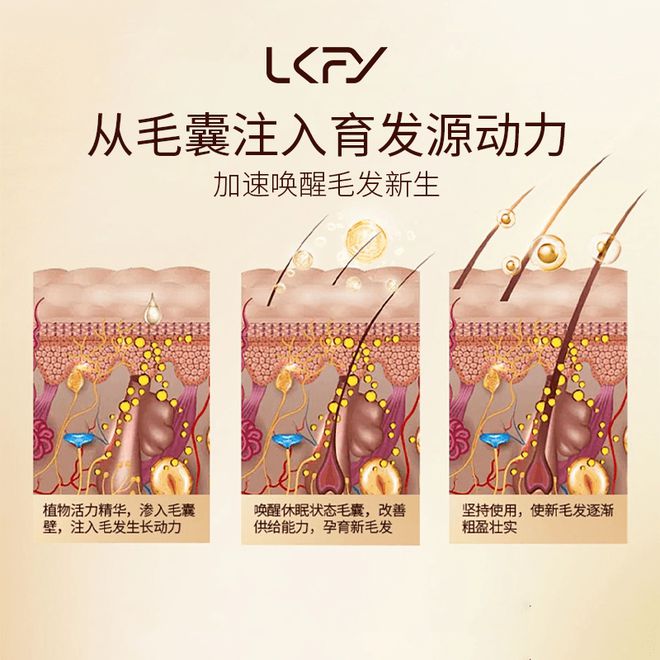 凯发手机app下载防脱洗发水哪个牌子的效